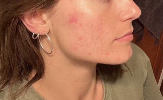 Facial Skincare Routine: Daily Step-by-Step Guide for All Skin Types