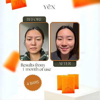 Skin Clearing Honey & Turmeric Bar