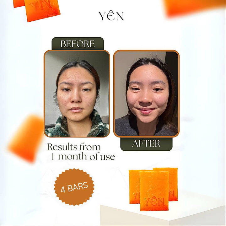 Acne Eraser Bundle
