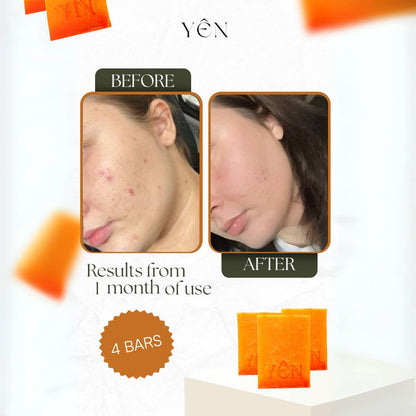 Skin Clearing Honey & Turmeric Bar