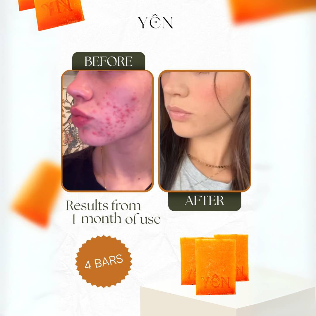 Skin Clearing Honey & Turmeric Bar