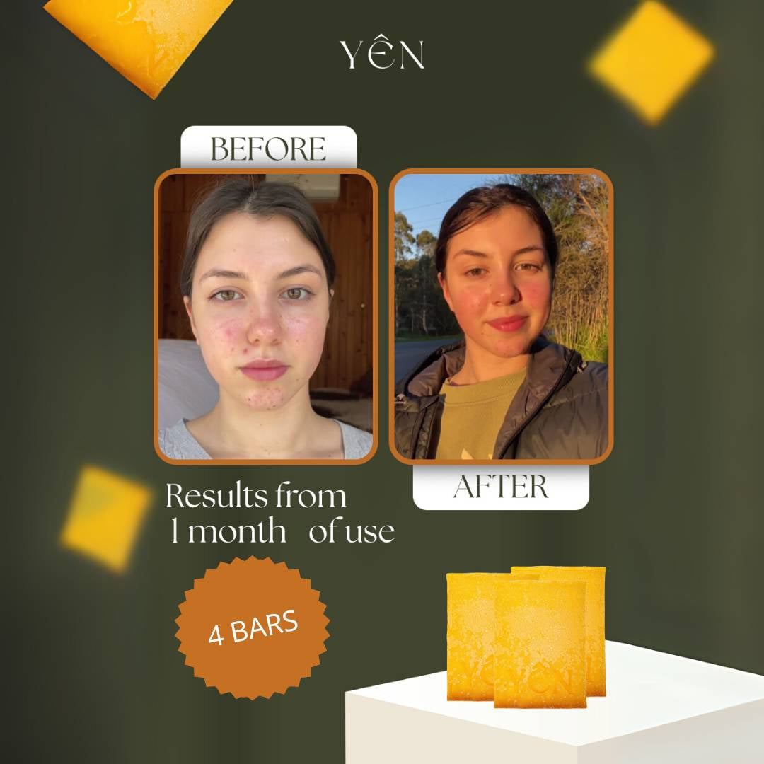 Skin Clearing Honey & Turmeric Bar