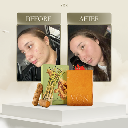 Dark Spot Fader Lemongrass & Turmeric Bar